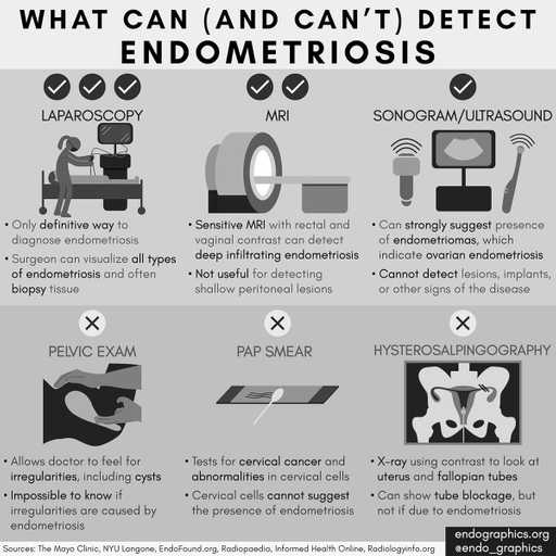 How Endometriosis Is Diagnosed | The Chronic