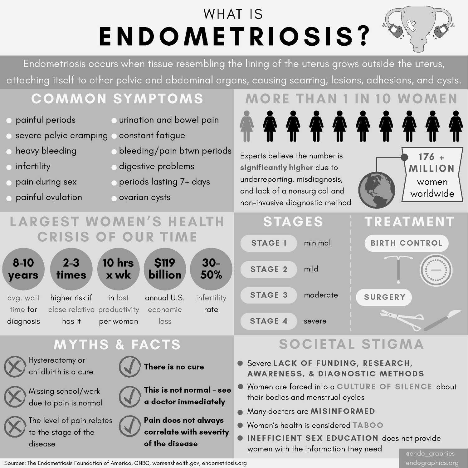 infographic on endometriosis facts